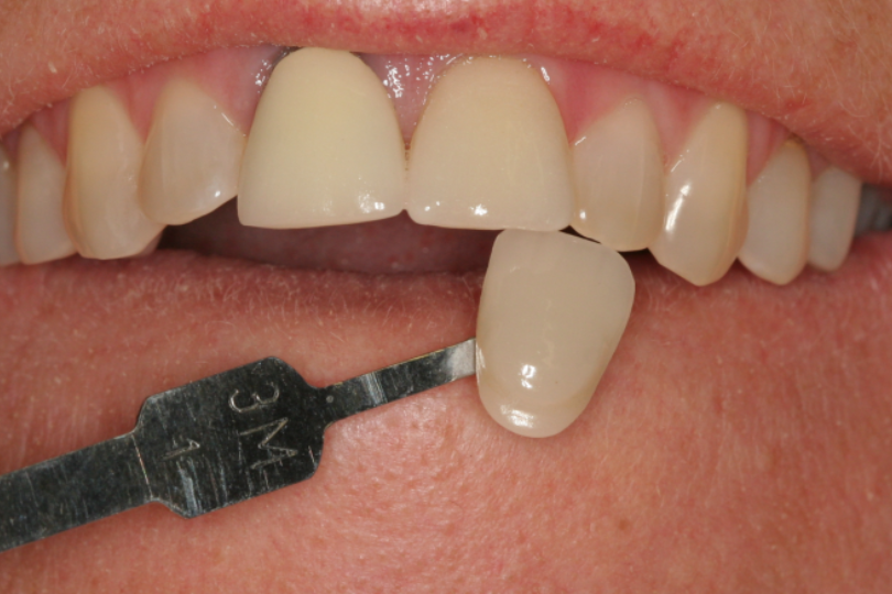 Treatment planning including investigations