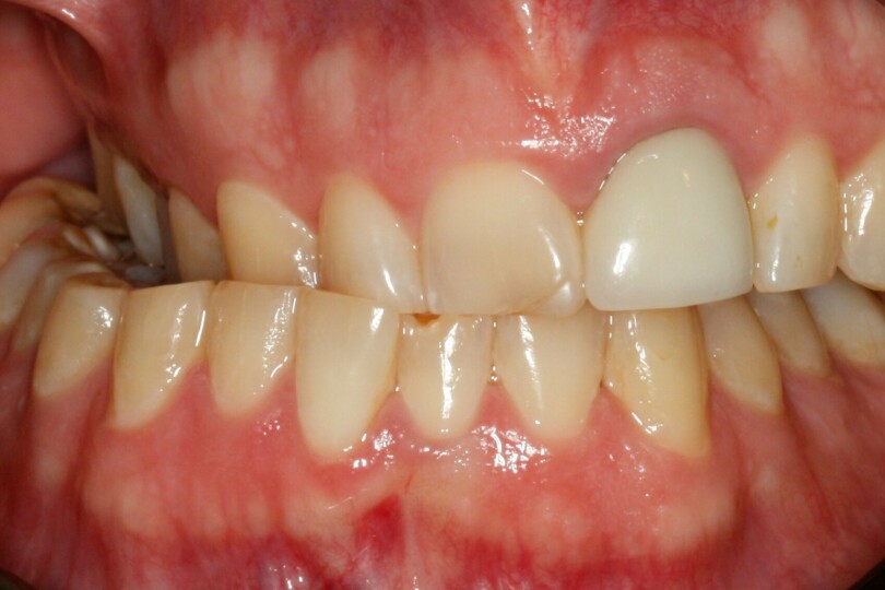 ADA Branch Meeting June 2024